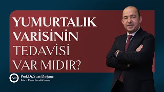 Yumurtalık Varisinin Tedavisi Var Mıdır [upl. by Salohcin]