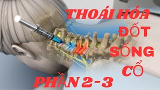 20THOÁI HÓA ĐỐT SỐNG CỔ phần 23CÁCH NHẬN BIẾT THOÁI HÓANGUYÊN NHÂN GÂY THOÁI HÓATÊ TAYYẾU CƠ [upl. by Curren]