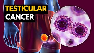 Testicular Cancer Causes Signs and Symptoms Diagnosis and Treatment [upl. by Aikas]