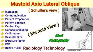 Mastoid Axio Lateral Oblique view  Schullers View in Hindi  Mastoid View [upl. by Quartus]