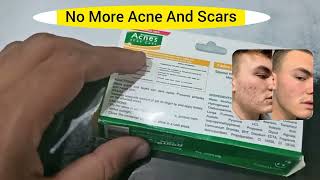 quotACNES SCAR CARE GEL FOR ACNES AND SCARSquot [upl. by Nuahsyd]