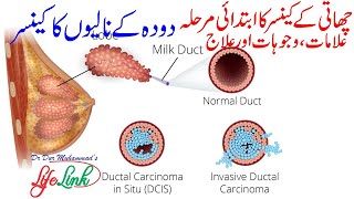 Ductal Carcinoma in Situ DCIS  Successful Natural Treatment of Breast Cancer [upl. by Kalila]