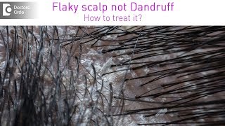 Get rid of itchy white flaky scalp which is not dandruff  Dr Rashmi Ravindra Doctors Circle [upl. by Leandre325]