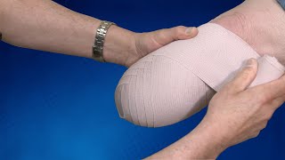 Wrapping Technique BK Residual Limb  Springer Prosthetic amp Orthotics Services [upl. by Nevets]