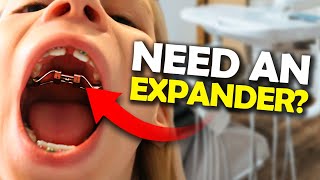 Getting a Palatal Expander What you NEED to know  McKinney Orthodontist [upl. by Aidnama414]