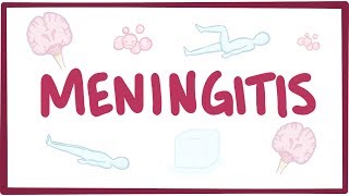 Meningitis  causes symptoms diagnosis treatment pathology [upl. by Atte]