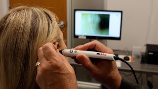 MedRx Video Otoscope Benefits [upl. by Farly]