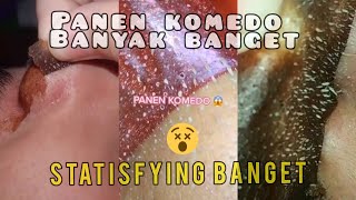 Panen Komedo Banyak banget  Statisfying masker komedo [upl. by Wenonah]