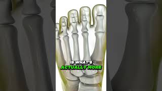 Do Bunion Correctors Work How to shrink bunions naturally [upl. by Drofniw]