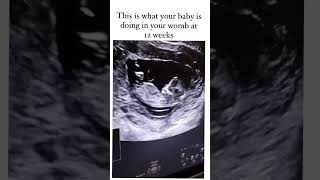 This is What You Baby is Doing in Your Womb at 12 Weeks  3 Month Pregnancy  pregnanvy [upl. by Nirhtak]