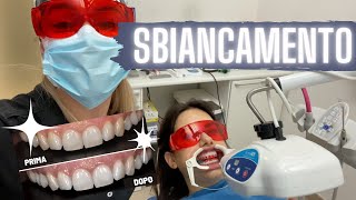 SBIANCAMENTO dei DENTI in studio  Prima e Dopo e intervista a Jasmine [upl. by Kienan]