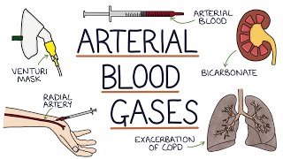 Understanding Arterial Blood Gases [upl. by Gratt964]