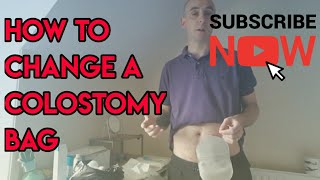 How to change a colostomy stoma bag [upl. by Eicul]