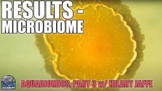 AquaBiomics Part 3  Results of My Tanks Microbiome  Hilary Jaffe [upl. by Kosel]