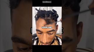 How to fix a Cowlick Hairline [upl. by Lamonica74]