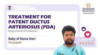 Treatment for Patent Ductus Arteriosus PDA  Preterm Birth  Placenta Previa  Yashoda Hospitals [upl. by Alten]