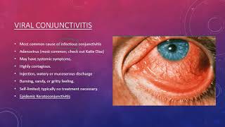 Conjunctivitis [upl. by Nauqel]