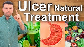 How to Cure Gastric Ulcers Caused by Gastritis  Home Remedies Juices and Supplements for Ulcers [upl. by Irianat]