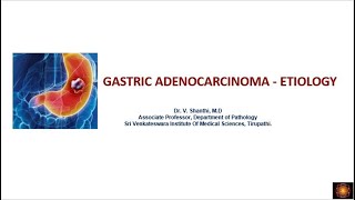 Gastric carcinoma etiopathogenesis [upl. by Harrow]