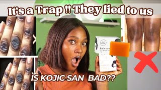 WHY KOJIC SAN SOAP IS NOT WORKING FOR YOU  HOW TO SPOT THE FAKE  Do’s amp Don’t [upl. by Nahk604]