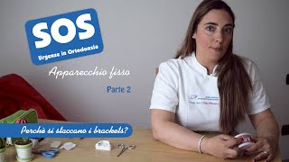 SOS Apparecchio Fisso  Perchè si staccano i brackets [upl. by Janerich]