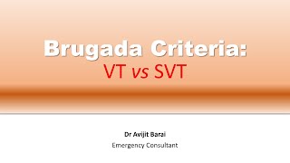 Brugada criteria How to differentiate VT from SVT [upl. by Dur]