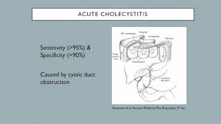 Nuclear medicine hepatobiliary liver and spleen [upl. by Shimkus390]