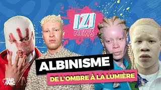 ALBINISME  FAIRE DE SA DIFFÉRENCE SA FORCE • IZI NEWS [upl. by Poul]