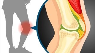 Sliding filament theory in muscle contraction  Wellcome [upl. by Leirum16]