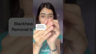 5 Mint Blackheads Remove at Home 😱✅ blackheads blackheadsremoval ytshorts skincare [upl. by Morganica]