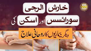 Kharish Allergy Psoriasis Aur Skin Ki Bimariyon Ka Rohani Ilaaj  Alhaj Syed Iqbal Bawa Qadri [upl. by Nonahs954]