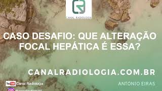 Caso Desafio Que Alteração Focal Hepática é Essa Alteração Perfusional x Esteatose Focal x ambos [upl. by Agrippina637]