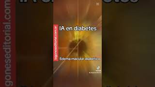 Inteligencia artificial y edema macular diabético [upl. by Rasure]