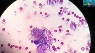 leishmania under the microscope  leishmaniose  الليشمانيا [upl. by Atiuqer]