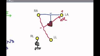 EKG 02 Electrodes and Leads [upl. by Enoid]