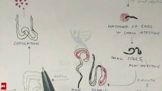 Trichuriasis  Whipworm structure Life cycle Symptoms and treatment  Bio science [upl. by Dunston]