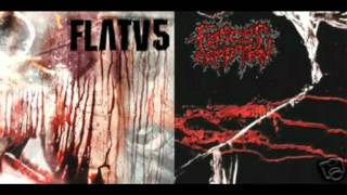 Faeces Eruption  16 Tracks [upl. by Harrod]