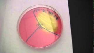 BIO 2192 UNIT 6  Selective amp Differential Media  Mannitol Salt Agar [upl. by Ennahgem]