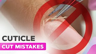 Donts When Cutting the Cuticle  Manicure Mistakes [upl. by Wane]