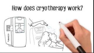 What is Cryotherapy  Cryotherapy Whiteboard Video [upl. by Ennoirb933]