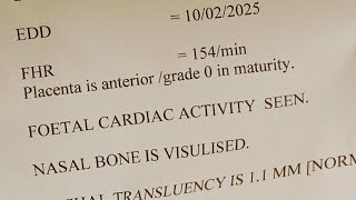 NT NB ultrasound report reading [upl. by Qidas]