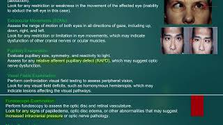 MRCP PACES NEUROLOGY STATION SIXTH NERVE PALSY [upl. by Reichel]