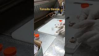 Tonsils tissue for histopathology [upl. by Adamsun]