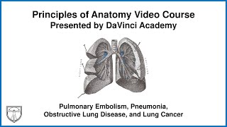 Pulmonary Embolism Pneumonia Obstructive Lung Disease and Lung Cancer Thorax Anatomy 7 of 16 [upl. by Bellda]