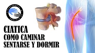 Ciatica por hernia discal como caminar sentarse y dormir para aliviar el dolor [upl. by Currey692]