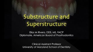 Implant Supported Substructure and Superstructure [upl. by Vlada]