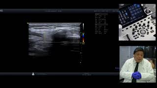 7° Masterclass 2021 Como realizar y aplicar la ecografia 3D y elastografia en patologia mamaria [upl. by Onez278]