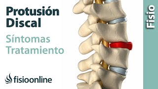 Protrusión de disco o discal  Qué es causas síntomas y tratamiento [upl. by Riki781]