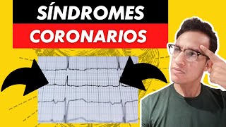 Síndromes coronarios ¿cómo puedo ayudar a mis pacientes SanofiSponsored [upl. by Adila300]