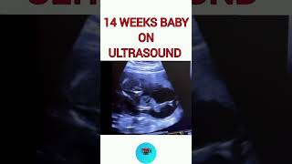 14 weeks baby on ultrasound pregnancy pregnancyjourney babyonusg [upl. by Hceicjow]